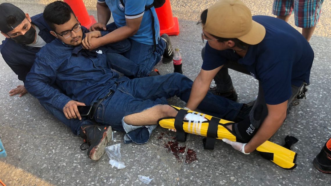 JOVEN TRABAJADOR SUFRE DOLOROSA FRACTURA